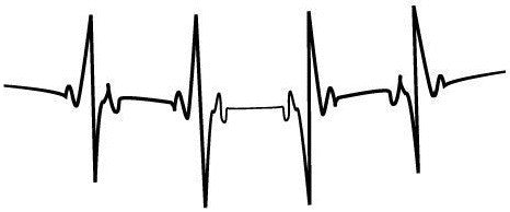 Tatouage temporaire pulsation coeur qui bat